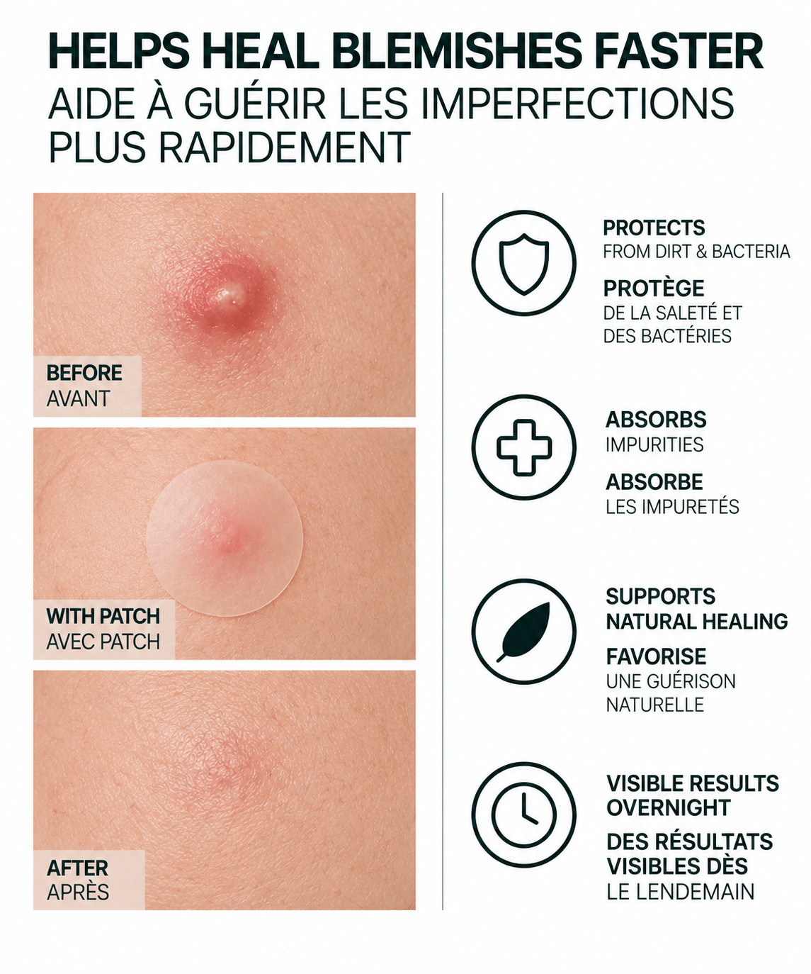 Hydrocolloid Acne Patches - LECRA